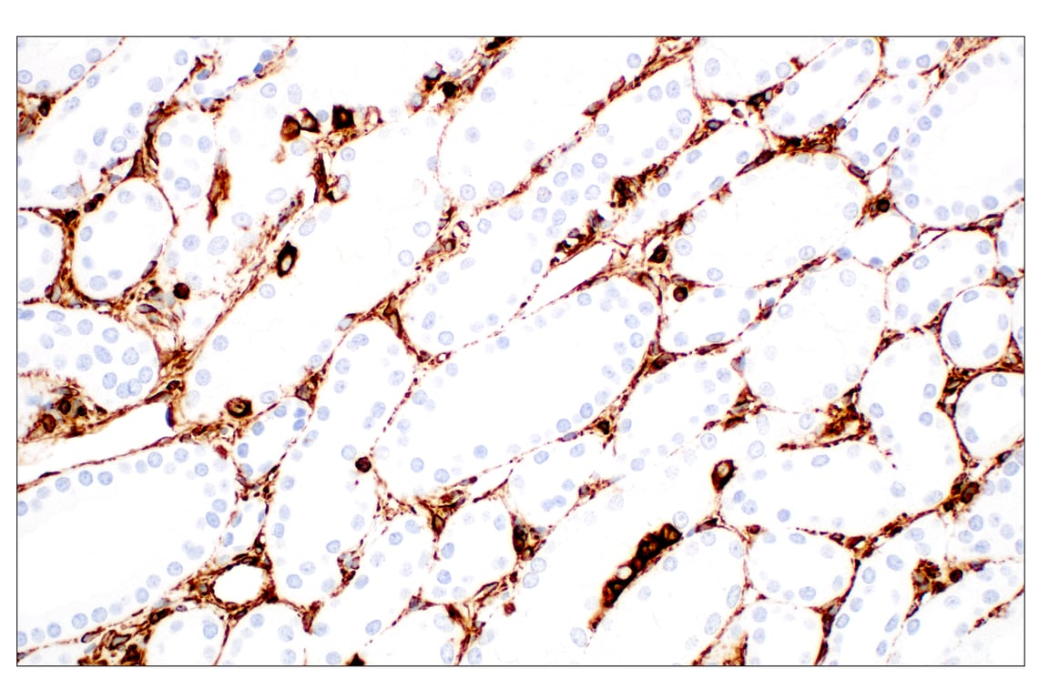 undefined Image 43: Cell Fractionation Antibody Sampler Kit