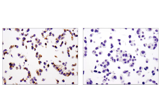 Immunohistochemistry Image 3: MDR1/ABCB1 (E1Y7S) Rabbit mAb