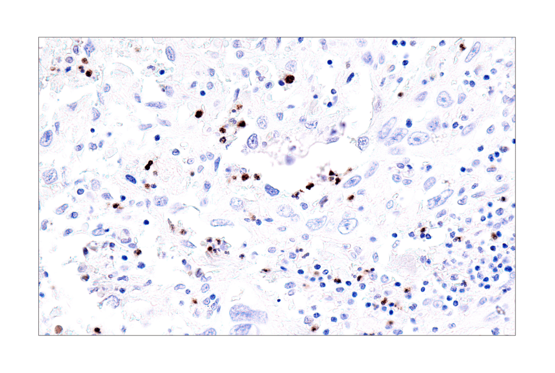 Immunohistochemistry Image 8: IL-8 (E5F5Q) XP<sup>®</sup> Rabbit mAb (BSA and Azide Free)