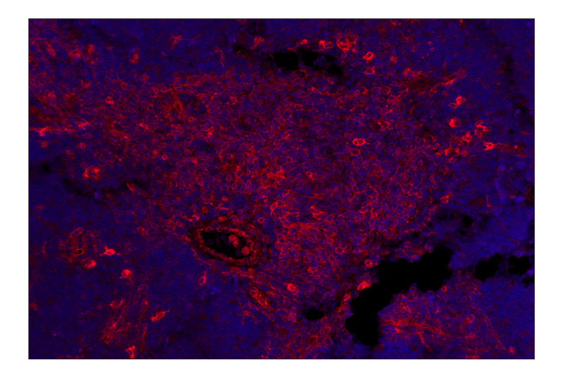 Immunohistochemistry Image 2: STING (D2P2F) Rabbit mAb (Alexa Fluor<sup>®</sup> 647 Conjugate)
