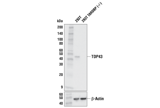 Western Blotting Image 2: TDP43 (E2G6G) Rabbit mAb
