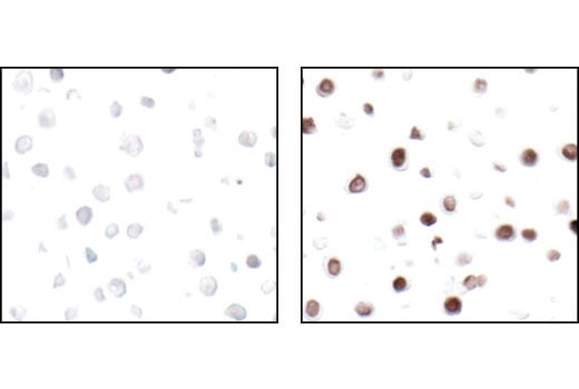 Immunohistochemistry Image 4: Phospho-Histone H2A.X (Ser139) (20E3) Rabbit mAb