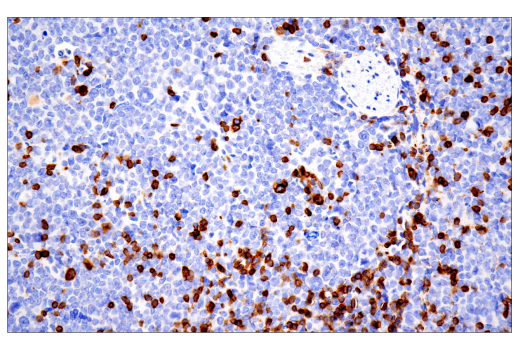 Immunohistochemistry Image 1: CD3ε (E4T1B) XP<sup>®</sup> Rabbit mAb (BSA and Azide Free)