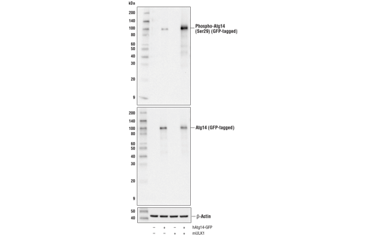 undefined Image 11: ULK1 Substrate Antibody Sampler Kit
