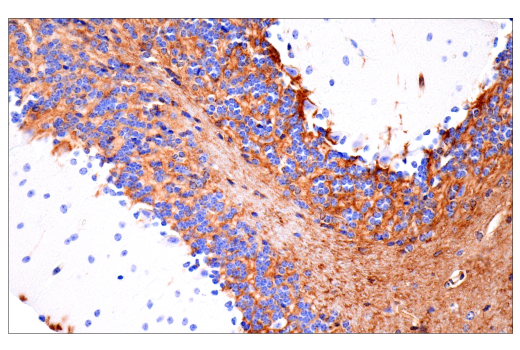 Immunohistochemistry Image 14: CD38 (E9F5A) XP<sup>®</sup> Rabbit mAb