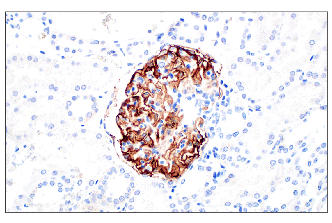 Immunohistochemistry Image 3: CR1/CD35 (E8B1Z) Rabbit mAb