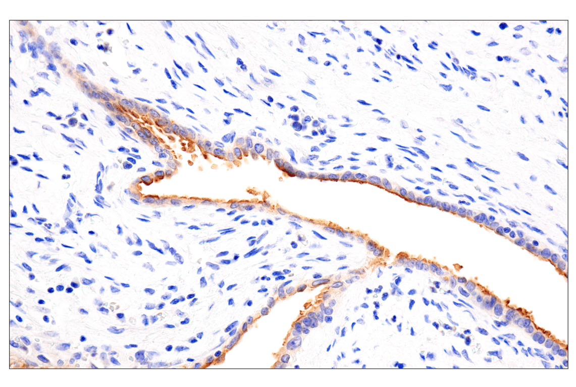 Immunohistochemistry Image 6: Folate Receptor Alpha/FOLR1 (BN3.2) Mouse mAb