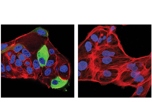 Immunofluorescence Image 1: Tyrosine Hydroxylase (E2L6M) Rabbit mAb