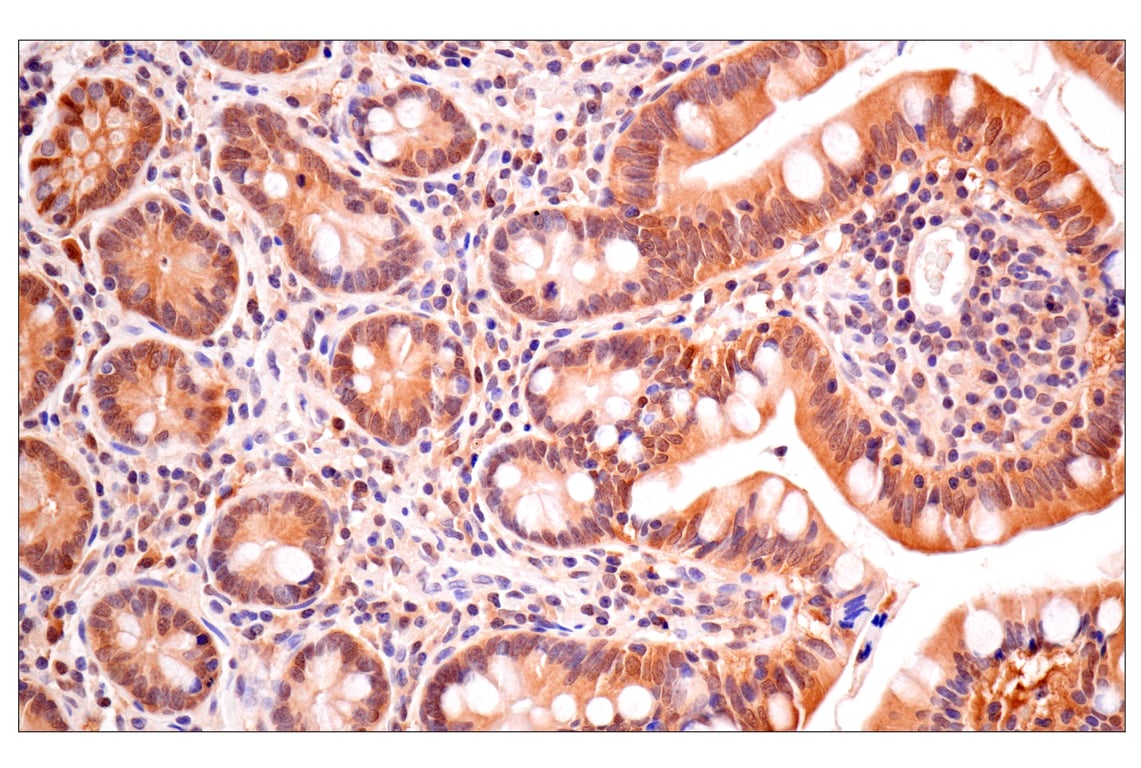 Immunohistochemistry Image 4: ACBP/DBI (E6K8G) XP<sup>®</sup> Rabbit mAb