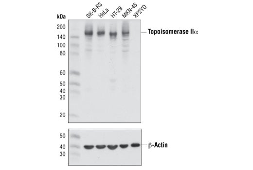 Western Blotting Image 1: Topoisomerase IIα (D10G9) XP<sup>®</sup> Rabbit mAb (BSA and Azide Free)