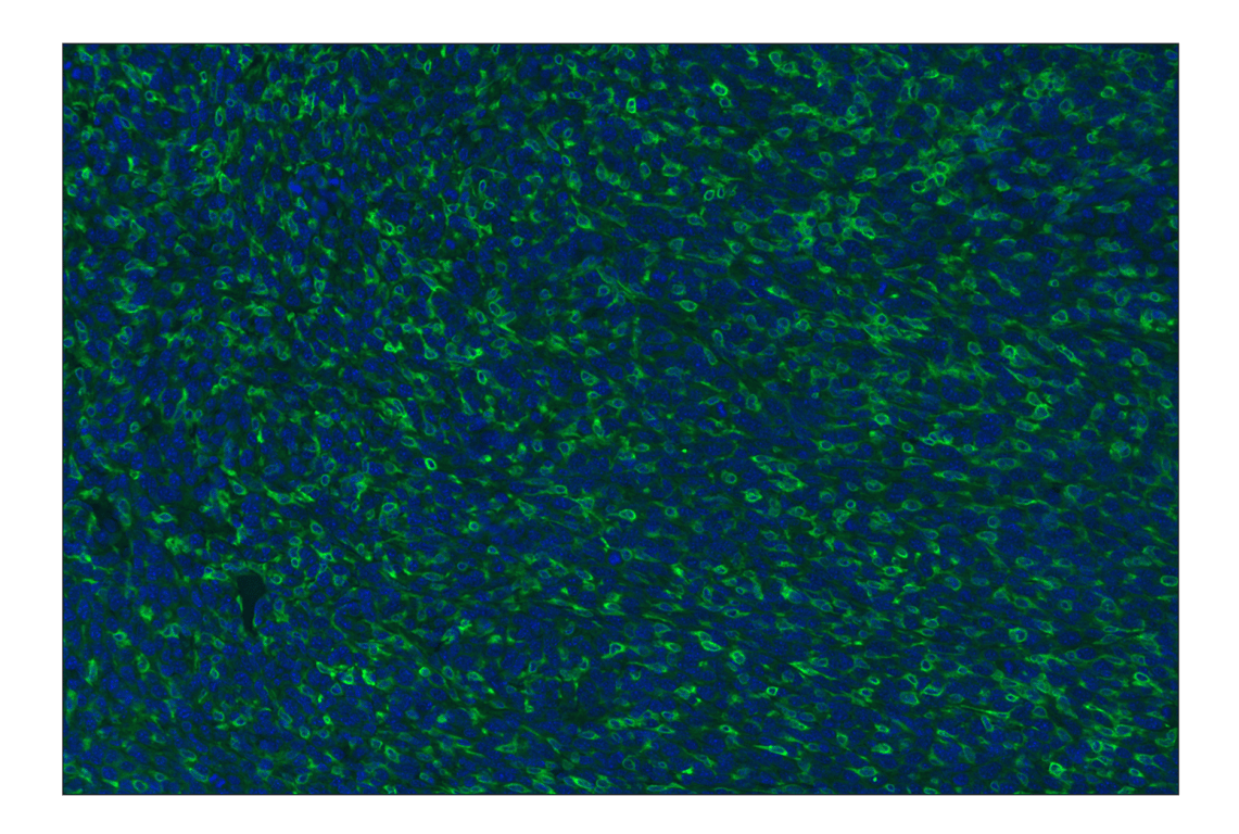 Immunohistochemistry Image 1: CD11b/ITGAM (E4K8C) Rabbit mAb (Alexa Fluor® 488 Conjugate)