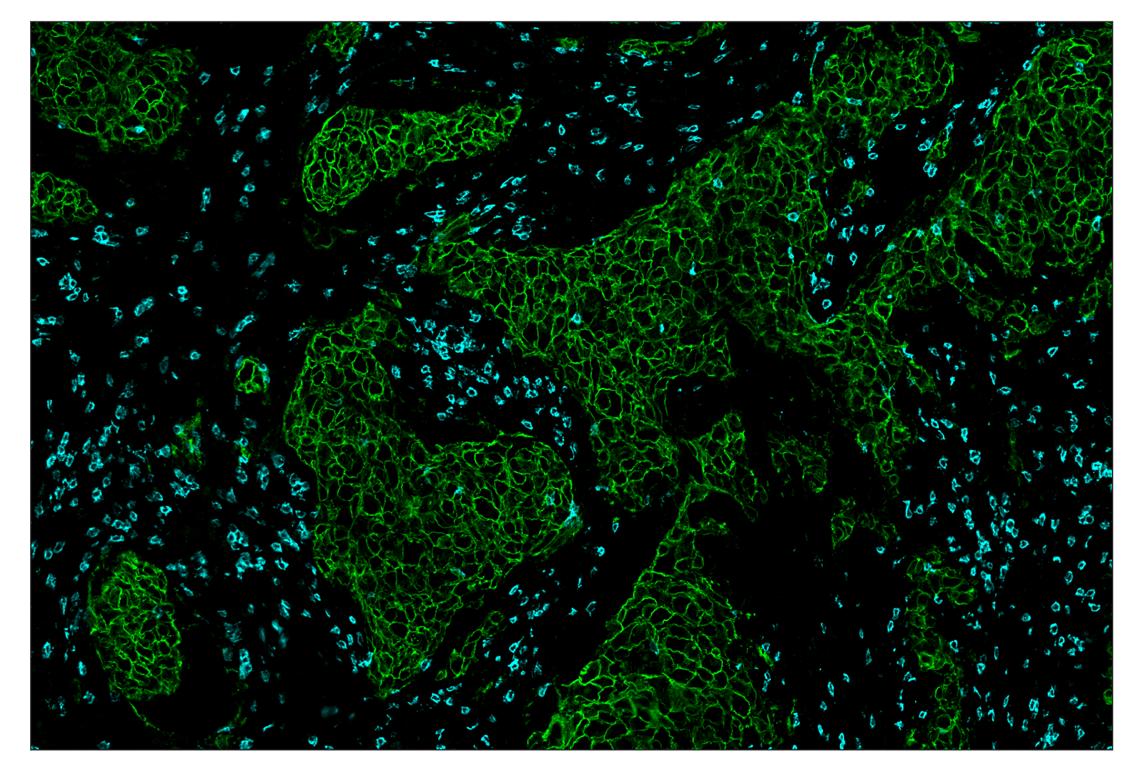 Immunohistochemistry Image 1: HER2/ErbB2 (D8F12) & CO-0059-488 SignalStar<sup>™</sup> Oligo-Antibody Pair
