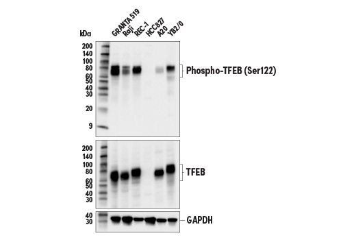 Western Blotting Image 1: Phospho-TFEB (Ser122) (E9M5M) Rabbit mAb (BSA and Azide Free)