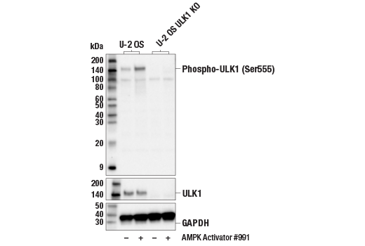 undefined Image 1: PhosphoPlus<sup>®</sup> ULK1 (Ser555) Antibody Duet