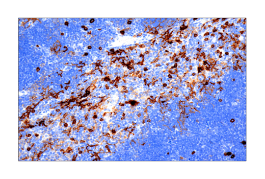 Immunohistochemistry Image 1: IL-2Rα/CD25 (E9W2J) XP<sup>®</sup> Rabbit mAb