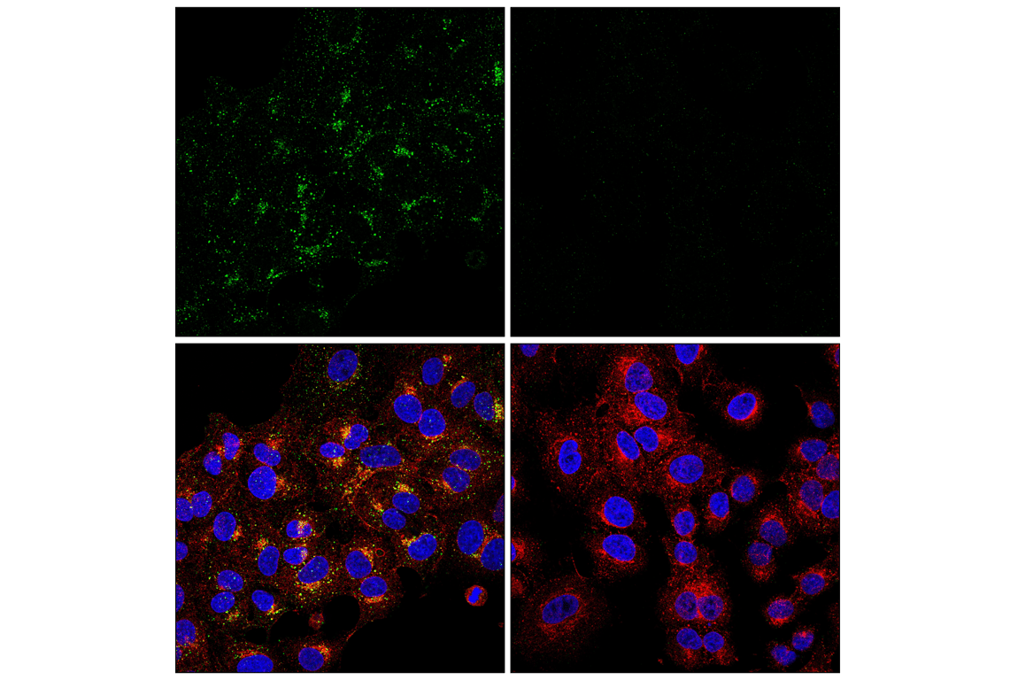 Immunofluorescence Image 1: APP (E8B3O) XP<sup>®</sup> Rabbit mAb