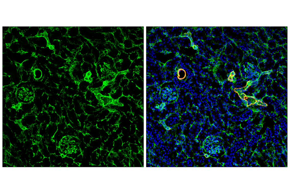Immunofluorescence Image 2: Caldesmon-1 (D5C8D) XP<sup>®</sup> Rabbit mAb
