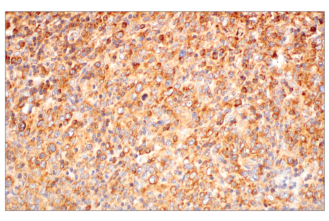 Immunohistochemistry Image 3: RACK1 (D59D5) Rabbit mAb