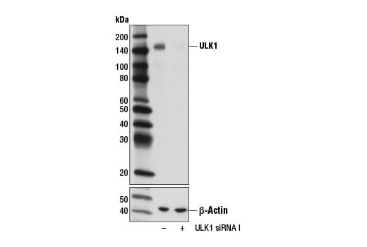 undefined Image 1: SignalSilence<sup>®</sup> ULK1 siRNA I