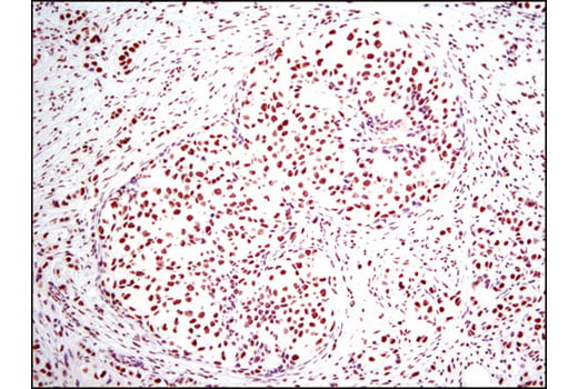 undefined Image 3: PhosphoPlus<sup>®</sup> Histone H3 (Ser10) Antibody Duet