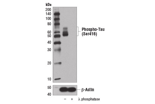 Western Blotting Image 1: Phospho-Tau (Ser416) (D7U2P) Rabbit mAb (BSA and Azide Free)