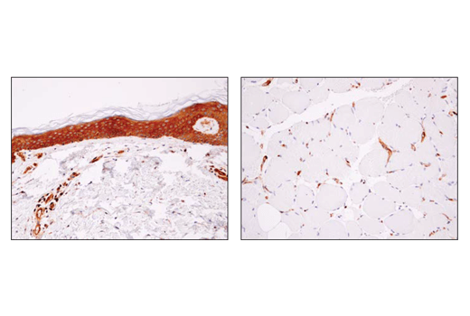 Immunohistochemistry Image 3: α-Actinin 4 (D7U5A) Rabbit mAb 