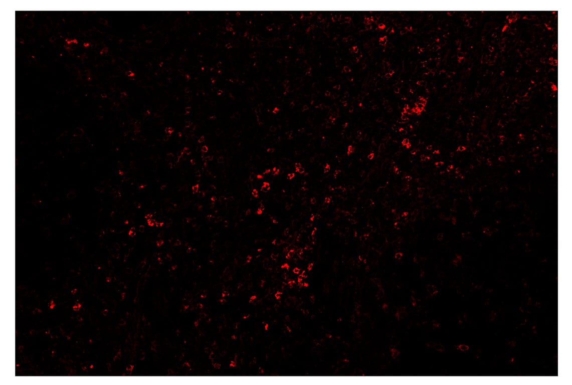 Immunohistochemistry Image 4: TIM-3 (D5D5R<sup>™</sup>) & CO-0010-750 SignalStar<sup>™</sup> Oligo-Antibody Pair