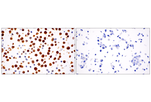 Immunohistochemistry Image 13: Calretinin (E7R6O) XP<sup>®</sup> Rabbit mAb