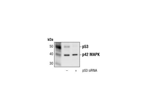 undefined Image 1: SignalSilence<sup>®</sup> p53 siRNA I