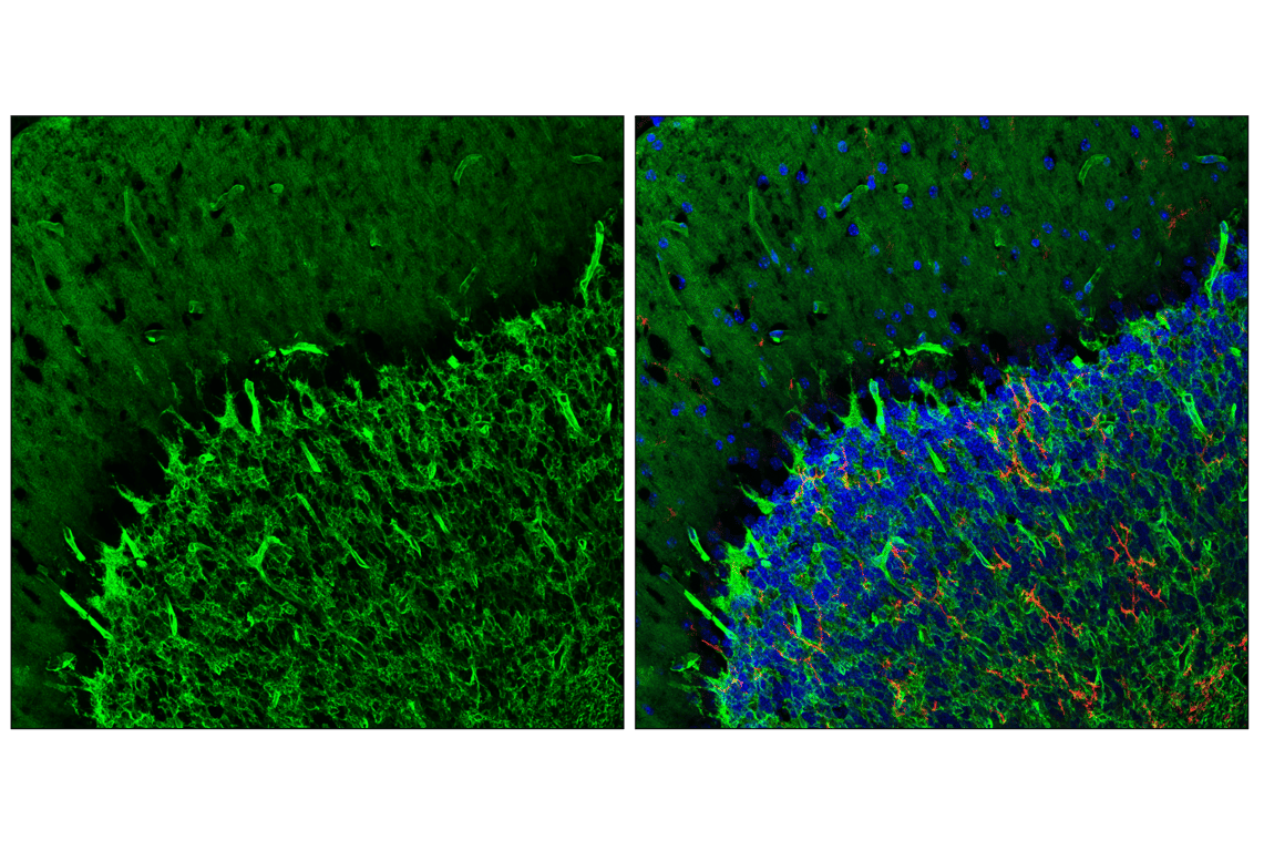 Immunofluorescence Image 1: AQP4 (E4B6T) Mouse mAb