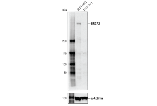 Western Blotting Image 2: BRCA2 (D9S6V) Rabbit mAb