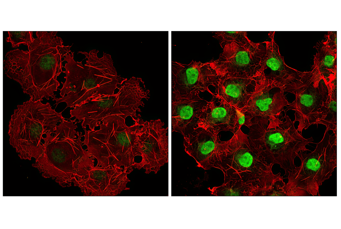 undefined Image 6: PhosphoPlus<sup>®</sup> p38 MAPK (Thr180/Tyr182) Antibody Duet