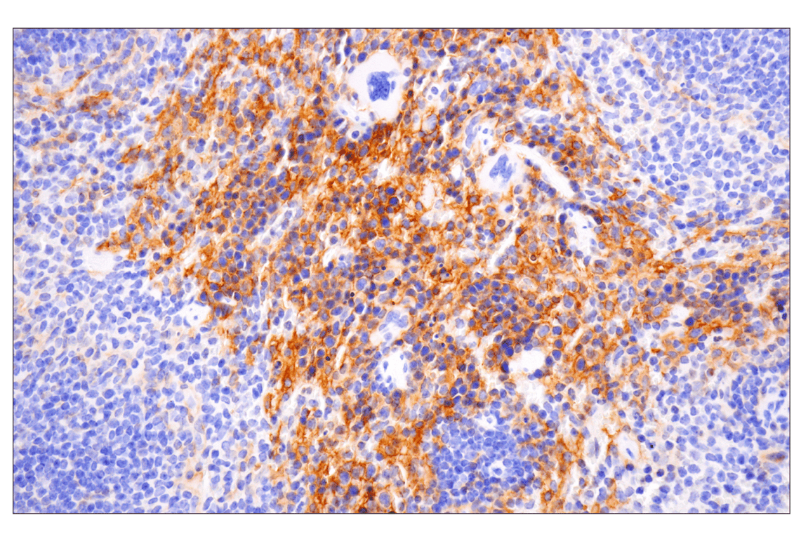 Immunohistochemistry Image 5: CD14 (D1U2Y) Rabbit mAb