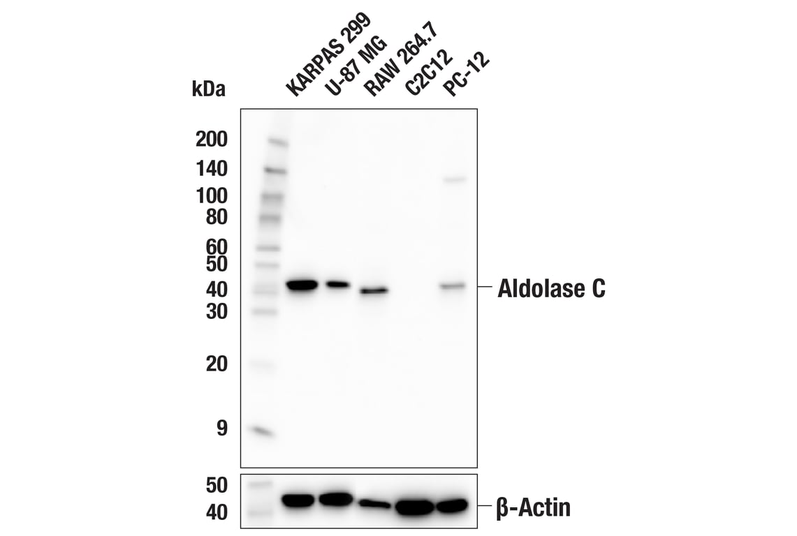 Western Blotting Image 2: Aldolase C (E7I4X) Rabbit mAb