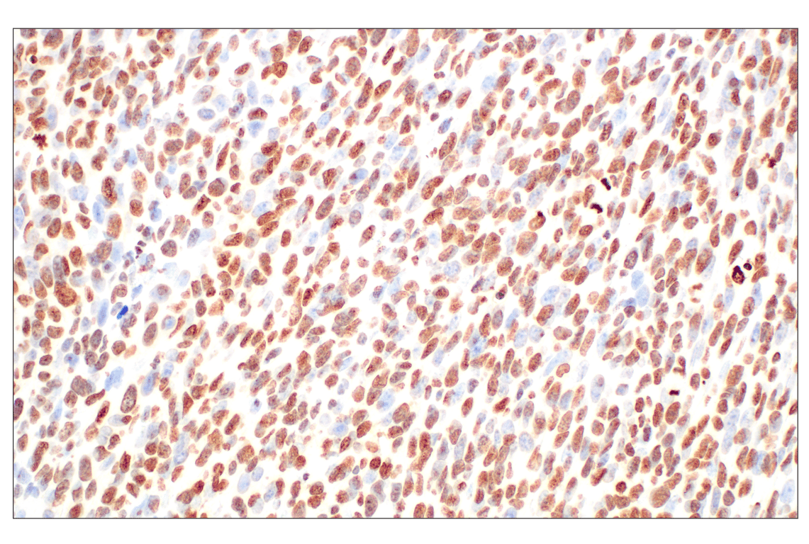 undefined Image 5: PhosphoPlus<sup>®</sup> Histone H3 (Ser10) Antibody Duet