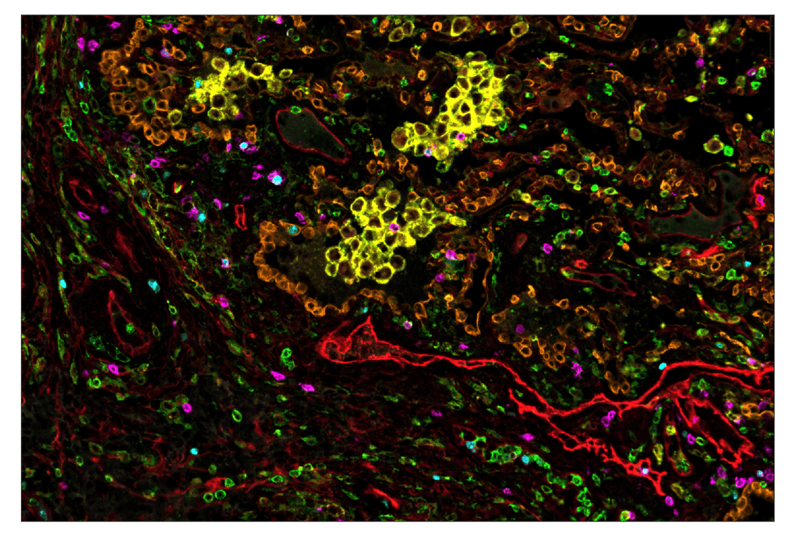 Immunohistochemistry Image 1: CD86 (E2G8P) & CO-0038-647 SignalStar<sup>™</sup> Oligo-Antibody Pair