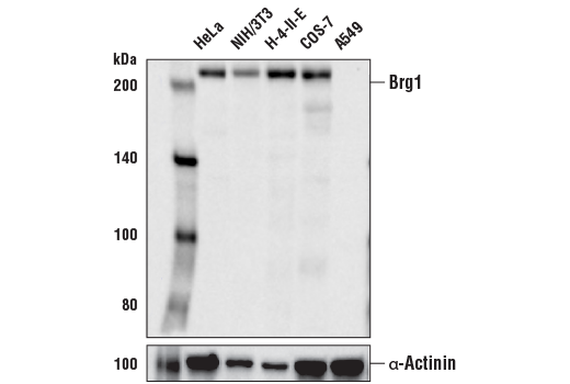 undefined Image 11: BAF Complex IHC Antibody Sampler Kit