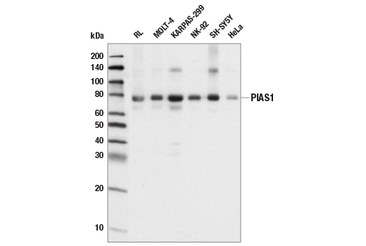 Western Blotting Image 1: PIAS1 (D33A7) XP<sup>®</sup> Rabbit mAb