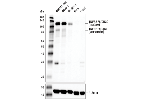 Western Blotting Image 2: TNFRSF8/CD30 (E1A6Y) Rabbit mAb