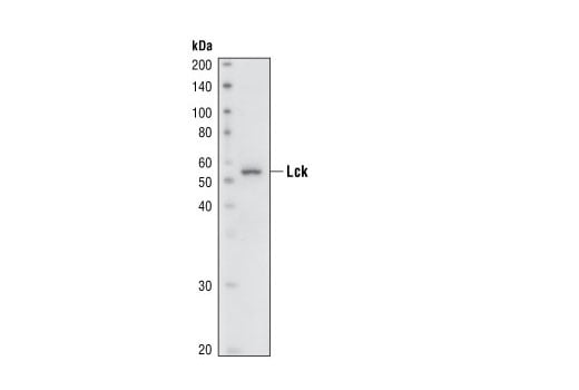 Western Blotting Image 1: Lck (73A5) Rabbit mAb (BSA and Azide Free)