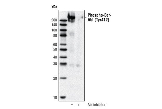 Western Blotting Image 2: Phospho-c-Abl (Tyr412) (247C7) Rabbit mAb