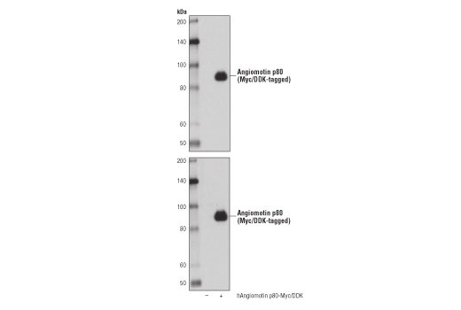Western Blotting Image 2: Angiomotin (D2O4H) Rabbit mAb