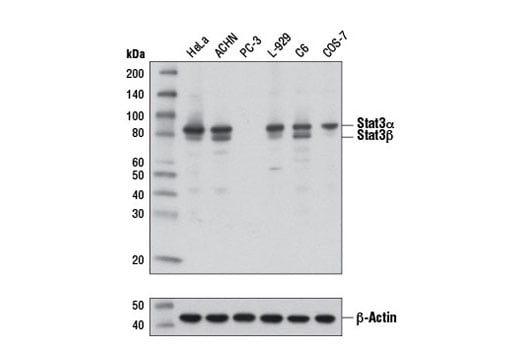 undefined Image 1: Stat3/Stat5 Signaling Antibody Sampler Kit