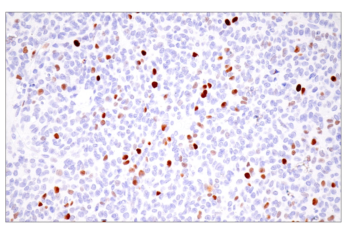 Immunohistochemistry Image 5: UHRF1 (E5W8W) Rabbit mAb