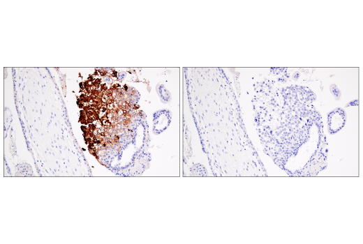Immunohistochemistry Image 2: HLA-G (E8N9C) XP<sup>®</sup> Rabbit mAb (BSA and Azide Free)