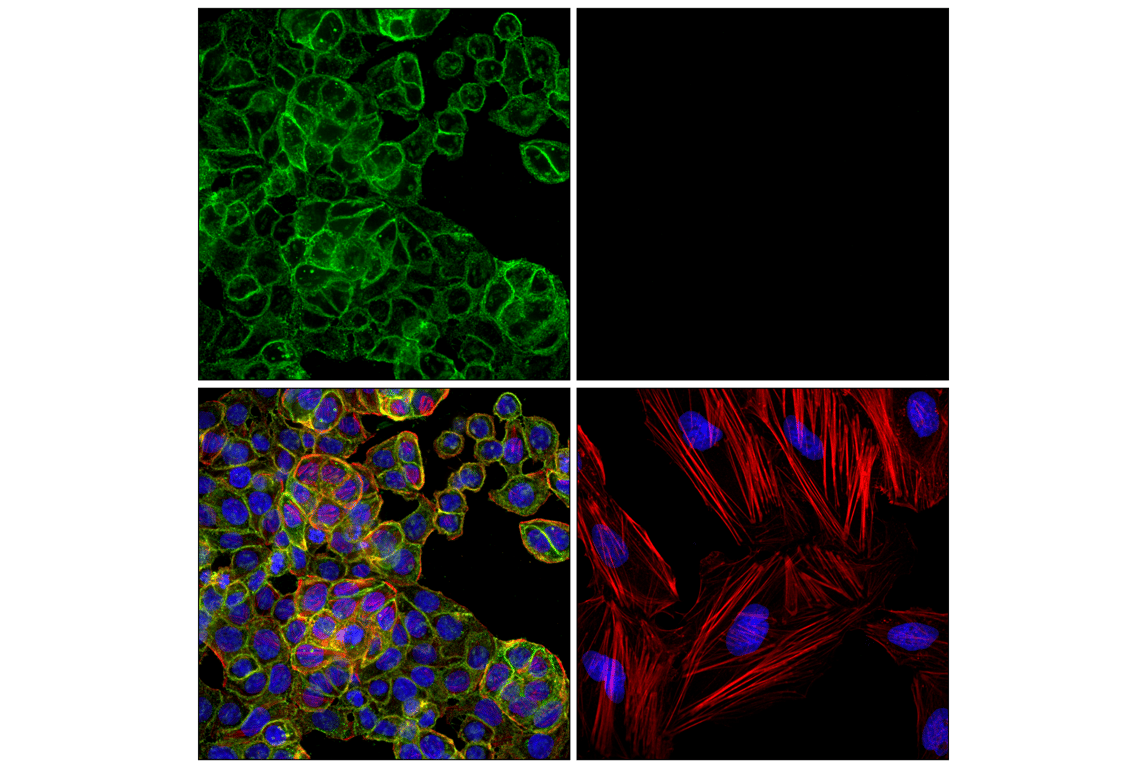 Immunofluorescence Image 1: EpCAM (VU1D9) Mouse mAb