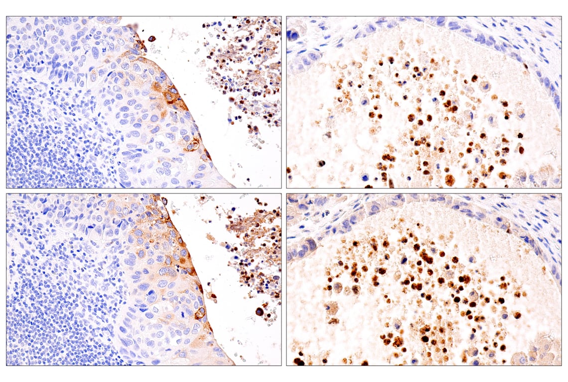 Immunohistochemistry Image 2: IL-8 (E5F5Q) XP<sup>®</sup> Rabbit mAb