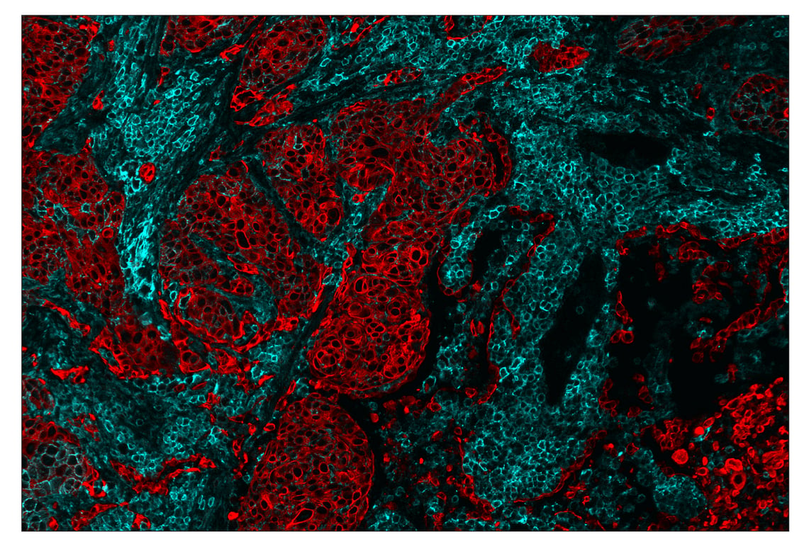 Immunohistochemistry Image 1: CD44 (E7K2Y) & CO-0030-647 SignalStar<sup>™</sup> Oligo-Antibody Pair