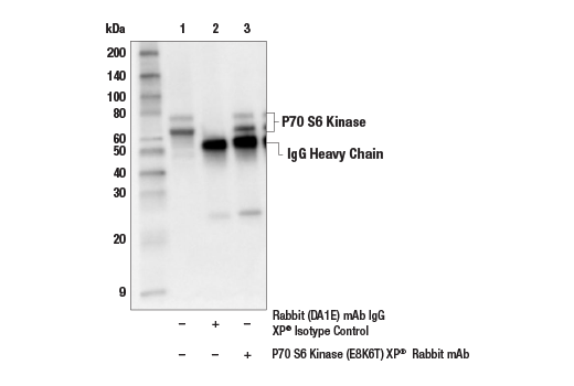 Immunoprecipitation Image 1: p70 S6 Kinase (E8K6T) XP<sup>®</sup> Rabbit mAb