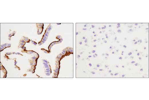 Immunohistochemistry Image 5: CD133 (D2V8Q) XP<sup>®</sup> Rabbit mAb